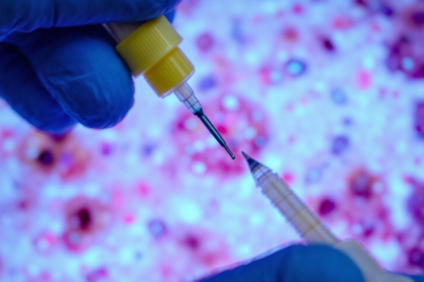 Lymphoma of the cat: life expectancy with cortisone therapy